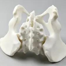 3D printed anatomical model for medical device development